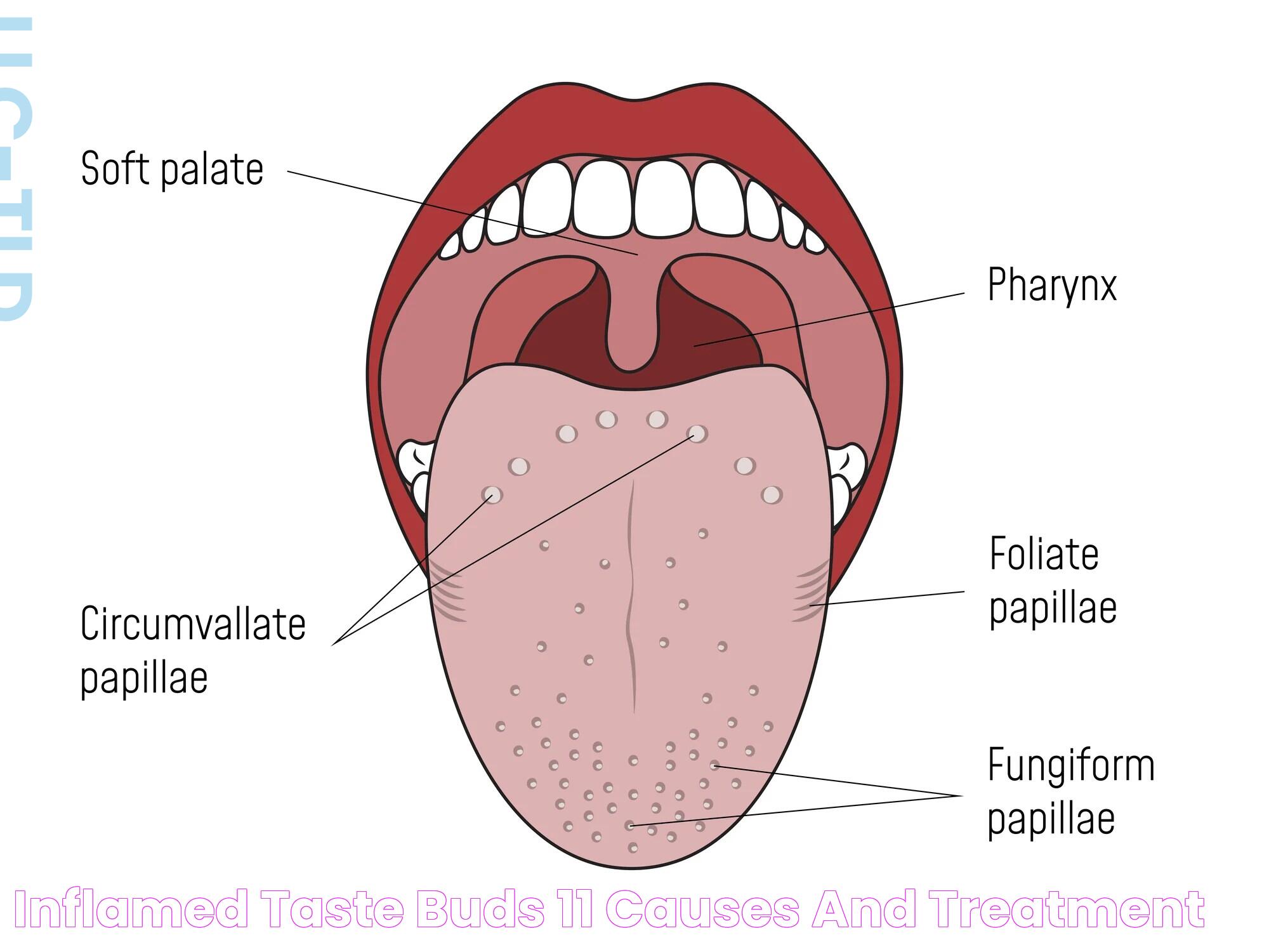 Causes And Remedies For Inflamed Taste Bud