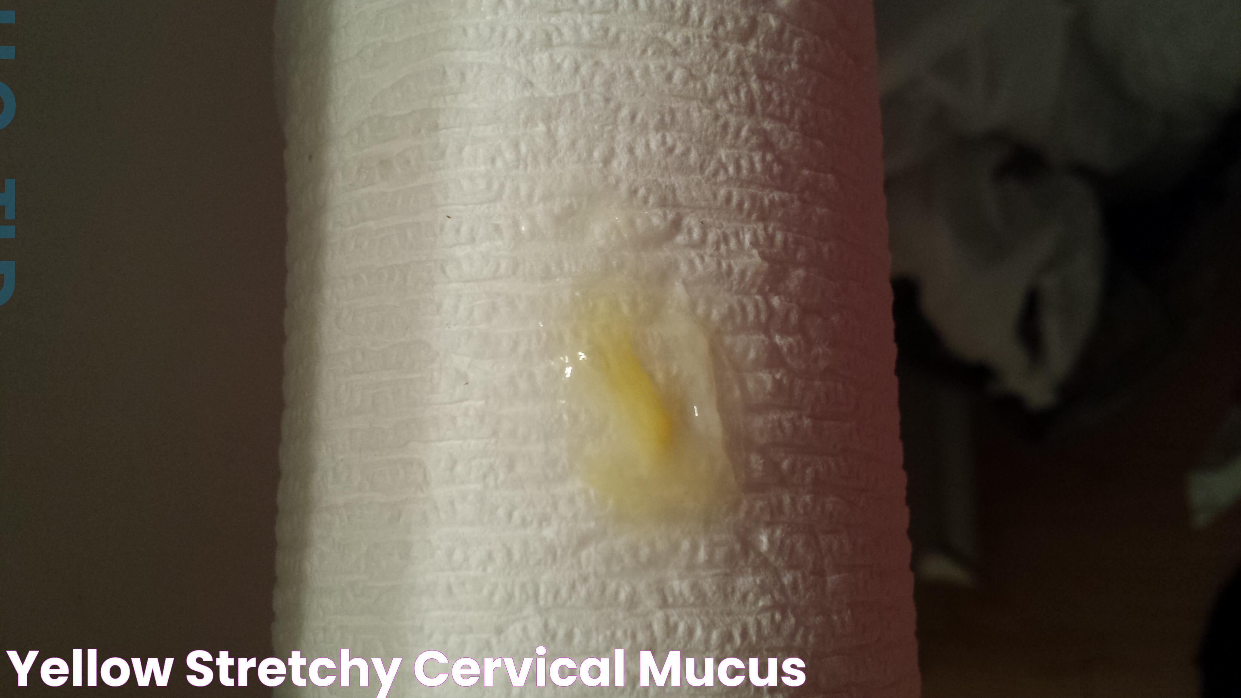 Greenish Yellow Mucus: Causes, Symptoms, And Treatments