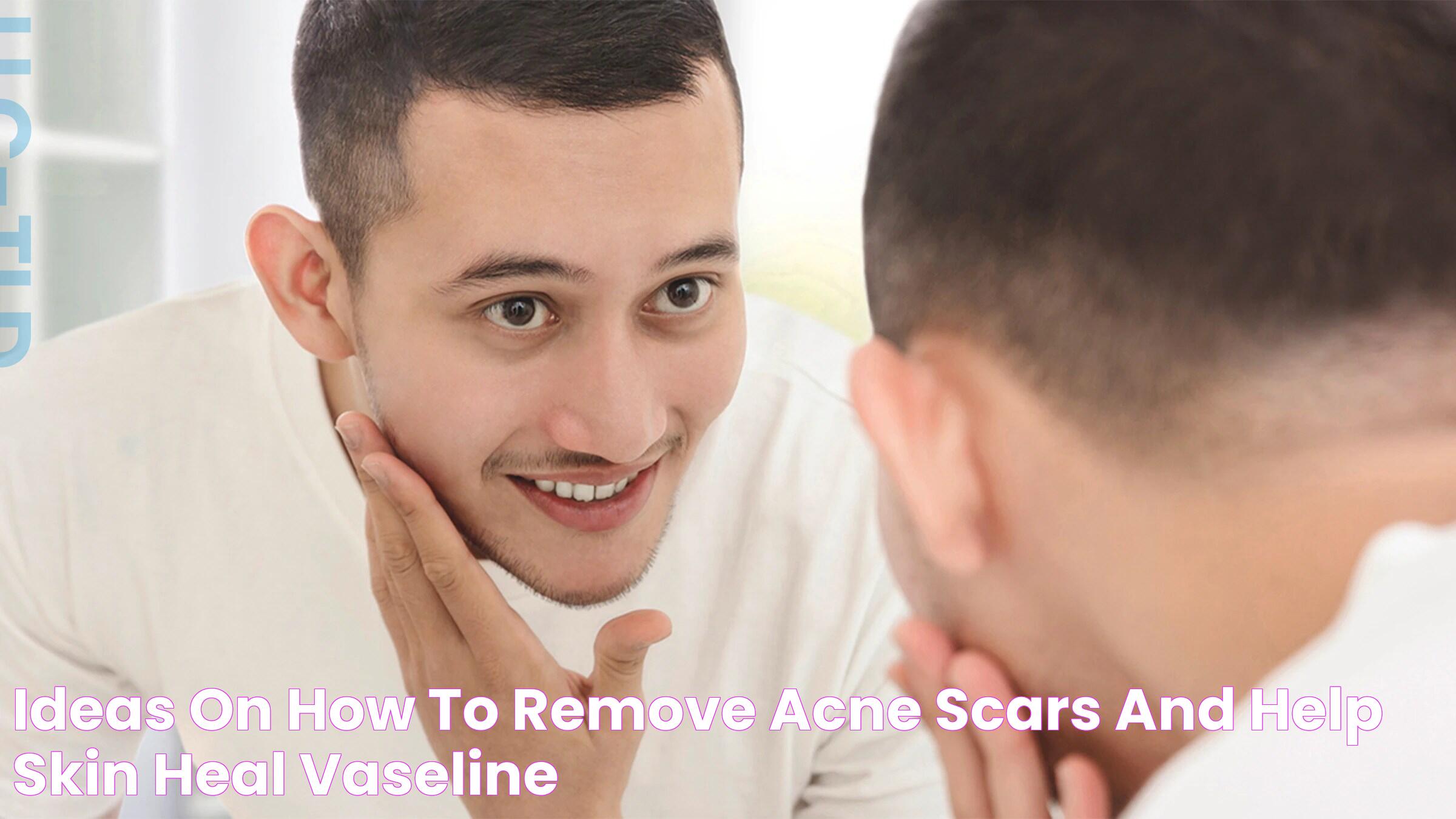 Ideas on How to Remove Acne Scars and Help Skin Heal Vaseline