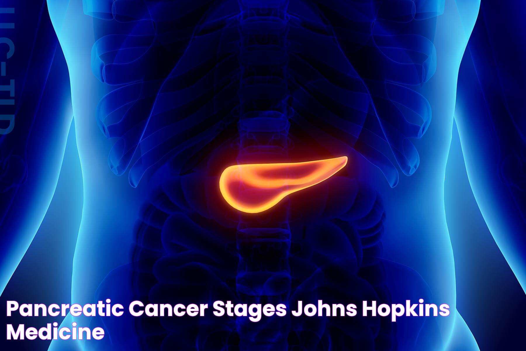 Pancreatic Cancer Stages Johns Hopkins Medicine