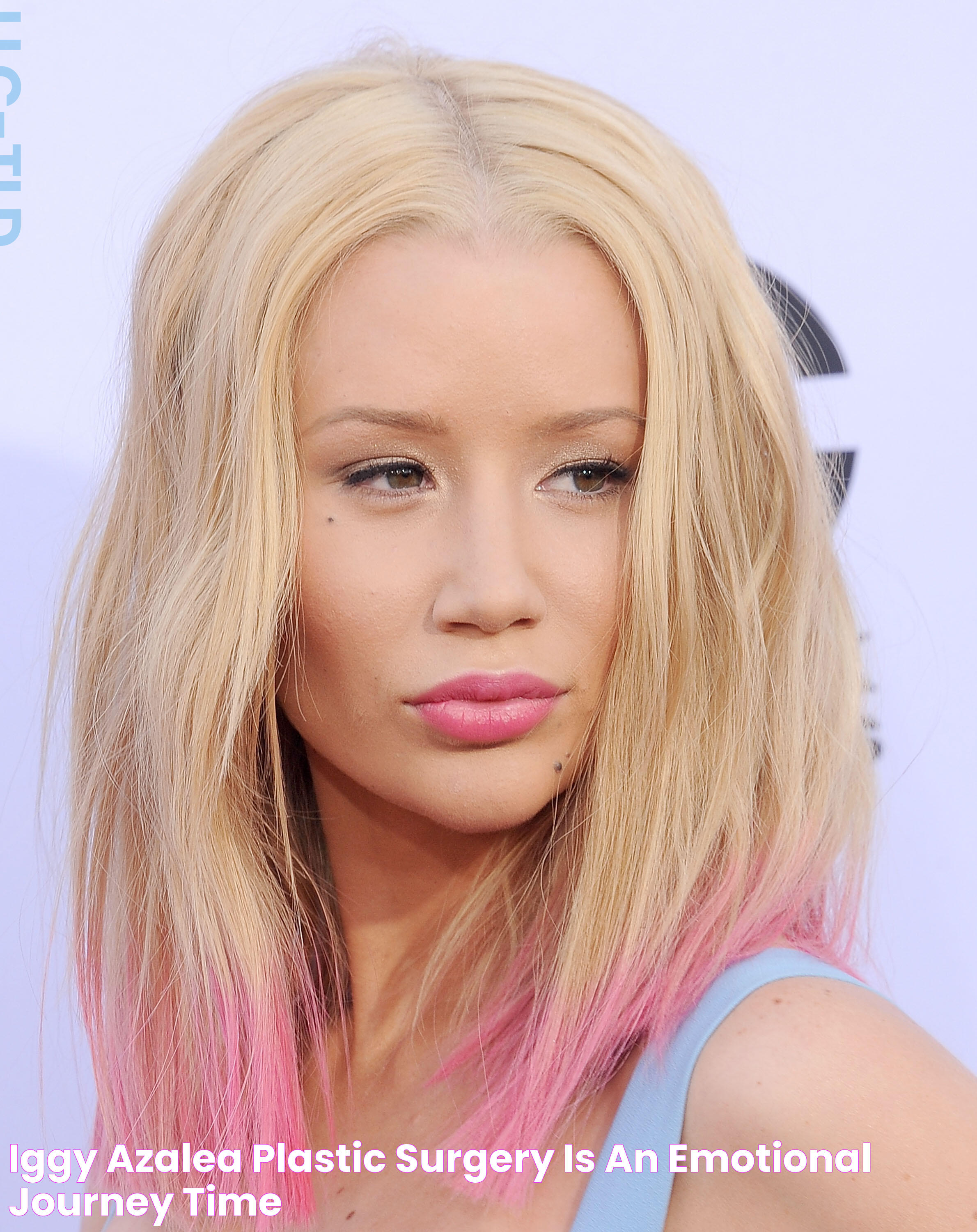 Iggy Azalea 'Plastic Surgery Is An Emotional Journey' TIME