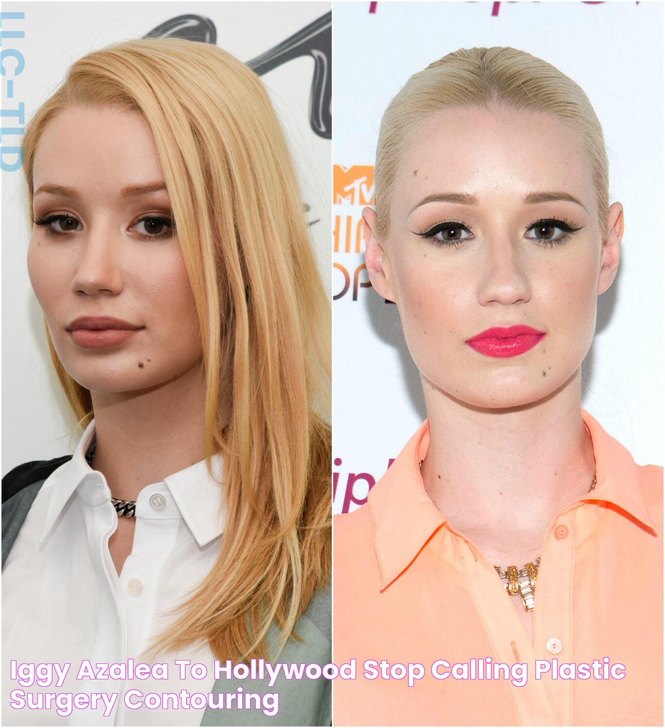 Did Iggy Azalea Have Plastic Surgery? Everything You Need To Know